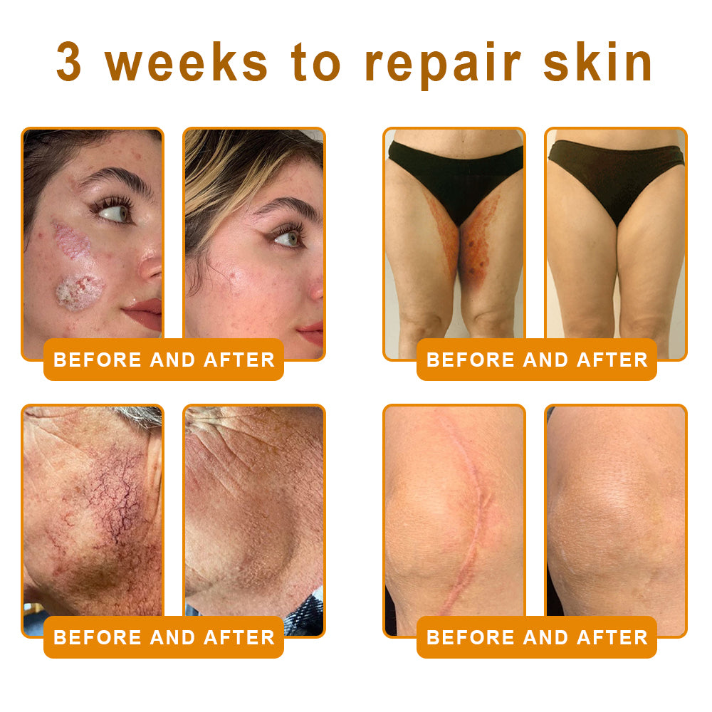 LOVILDS™ 🐝Bee Poison Skin Restoration Cream 🐝（🔥LAST DAY SALE-80% OFF)🥇👩‍⚕️ (Cópia)