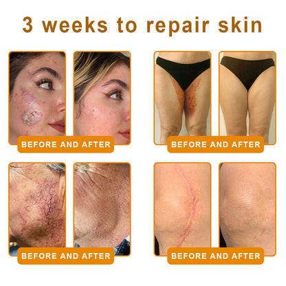LOVILDS™ 🐝Bee Poison Skin Restoration Cream 🐝（🔥LAST DAY SALE-80% OFF)🥇👩‍⚕️ (Cópia)