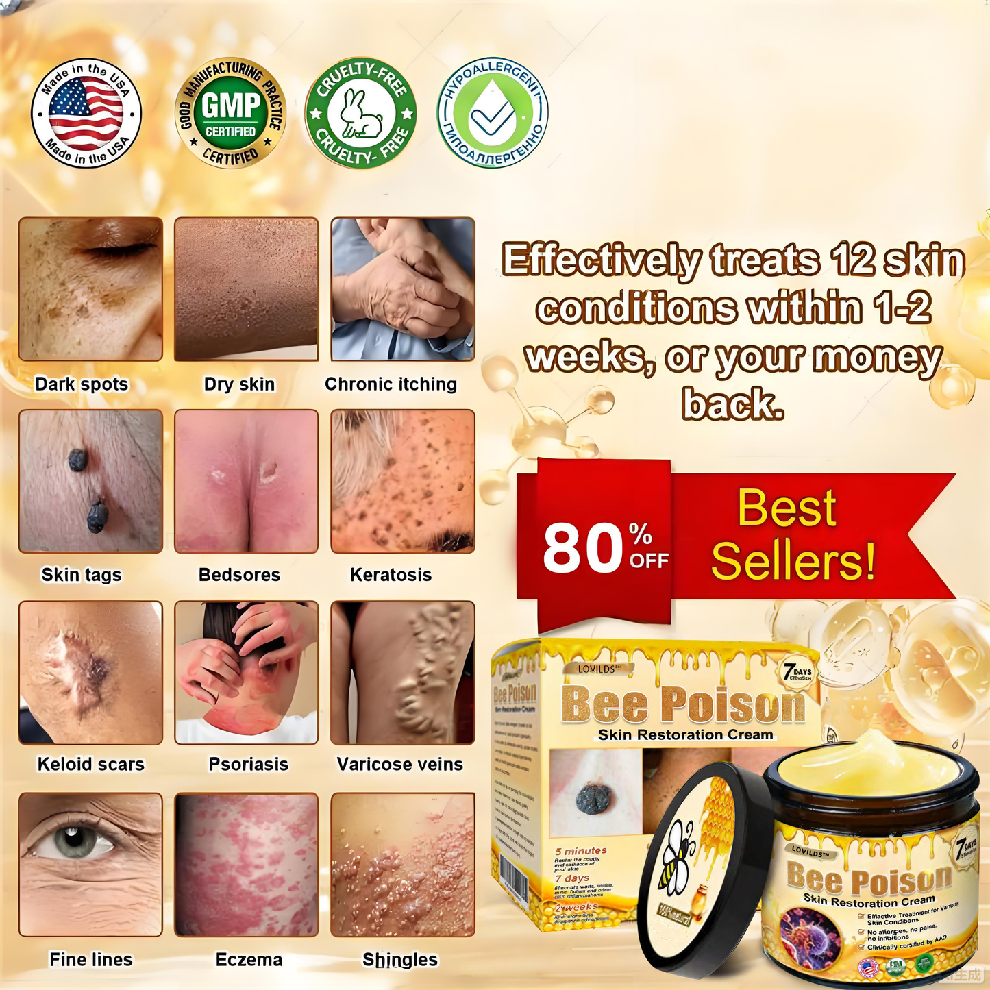 LOVILDS™ 🐝Bee Poison Skin Restoration Cream 🐝（🔥LAST DAY SALE-80% OFF)🥇👩‍⚕️ (Cópia)