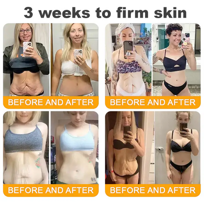 LOVILDS™ 🐝Bee Poison Skin Restoration Cream 🐝（🔥LAST DAY SALE-80% OFF)🥇👩‍⚕️ (Cópia)