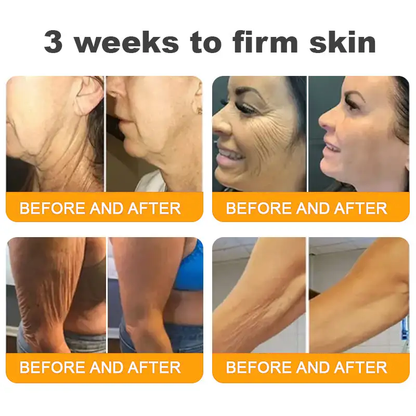 LOVILDS™ 🐝Bee Poison Skin Restoration Cream 🐝（🔥LAST DAY SALE-80% OFF)🥇👩‍⚕️ (Cópia)