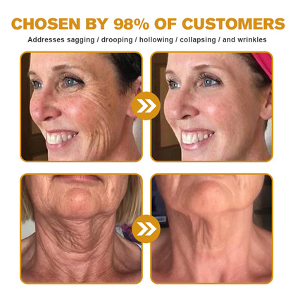 LOVILDS™ 🐝Bee Poison Skin Restoration Cream 🐝（🔥LAST DAY SALE-80% OFF)🥇👩‍⚕️ (Cópia)