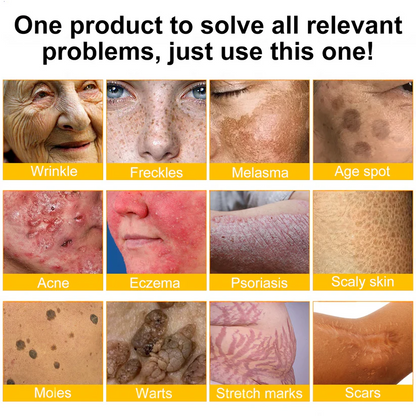 LOVILDS™ 🐝Bee Poison Skin Restoration Cream 🐝（🔥LAST DAY SALE-80% OFF)🥇👩‍⚕️ (Cópia)