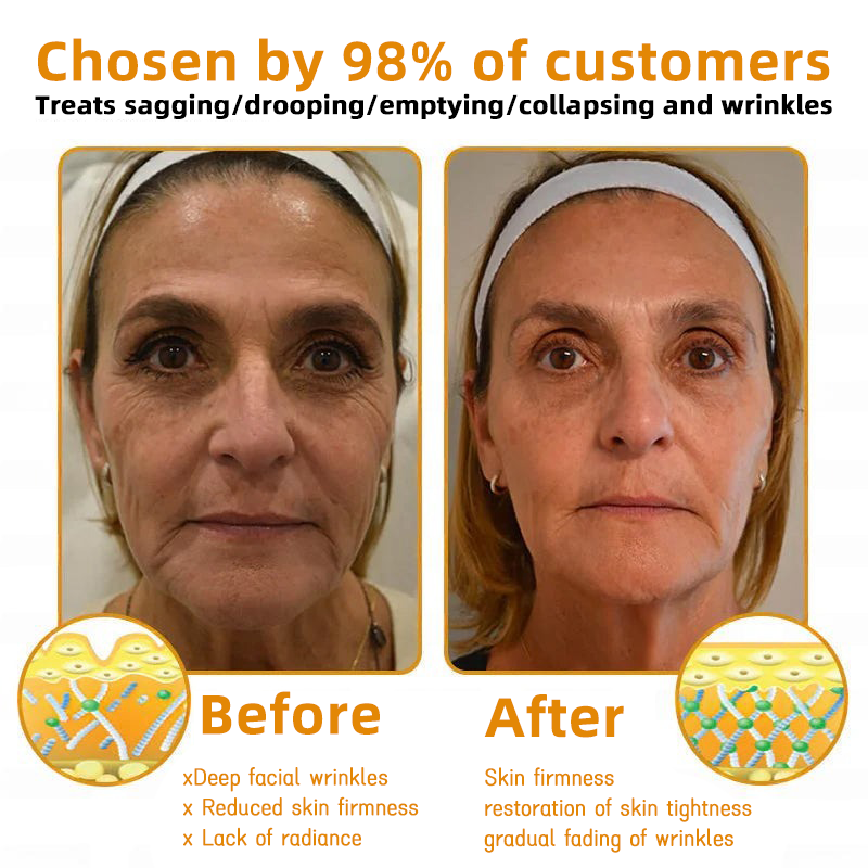 LOVILDS™ 🐝Bee Poison Skin Restoration Cream 🐝（🔥LAST DAY SALE-80% OFF)🥇👩‍⚕️ (Cópia)