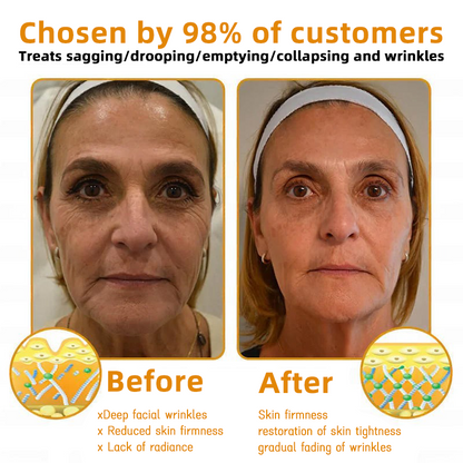 LOVILDS™ 🐝Bee Poison Skin Restoration Cream 🐝（🔥LAST DAY SALE-80% OFF)🥇👩‍⚕️ (Cópia)