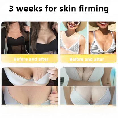 LOVILDS™ 🐝Bee Poison Skin Restoration Cream 🐝（🔥LAST DAY SALE-80% OFF)🥇👩‍⚕️ (Cópia)