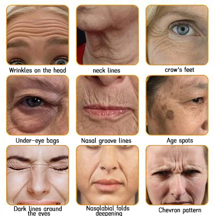 LOVILDS™ 🐝Bee Poison Skin Restoration Cream 🐝（🔥LAST DAY SALE-80% OFF)🥇👩‍⚕️ (Cópia)
