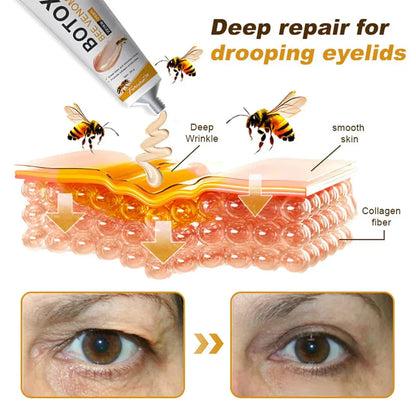 Creme para tratamento instantâneo de rugas com veneno de abelha e botox