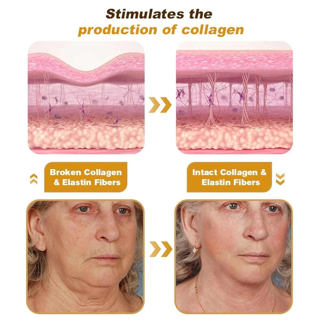 Creme para tratamento instantâneo de rugas com veneno de abelha e botox