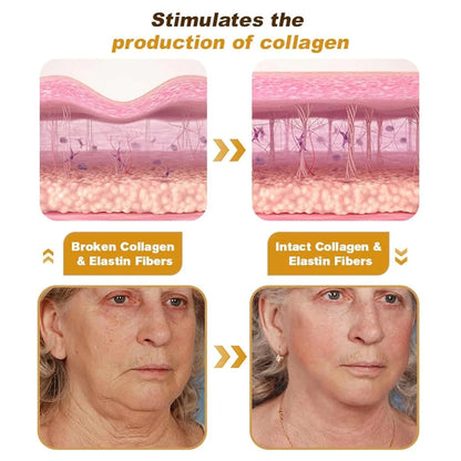 Creme para tratamento instantâneo de rugas com veneno de abelha e botox