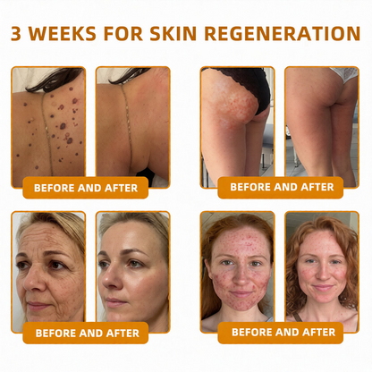LOVILDS™ 🐝Bee Poison Skin Restoration Cream 🐝（🔥LAST DAY SALE-80% OFF)🥇👩‍⚕️ (Cópia)