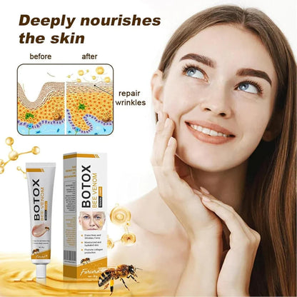 Creme para tratamento instantâneo de rugas com veneno de abelha e botox